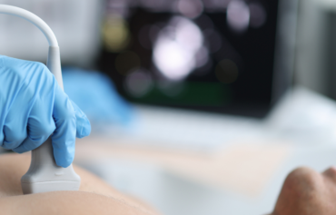 Echocardiogram
