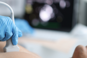 Echocardiogram