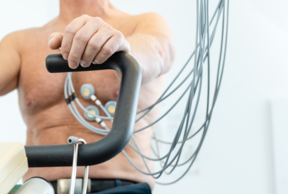 Exercise Stress Testing
