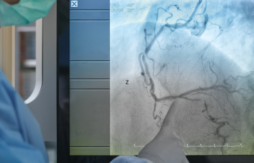 Angiogram & Stenting